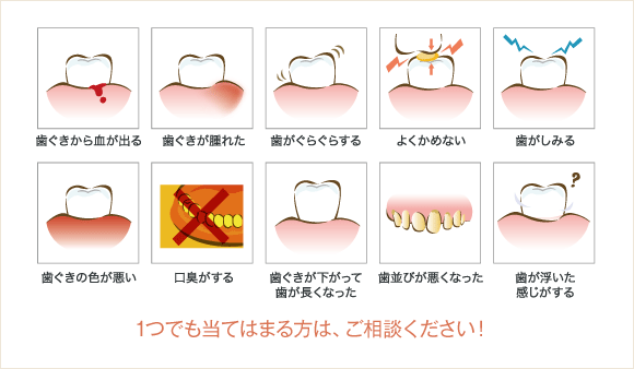 歯周病の疑いがある症状